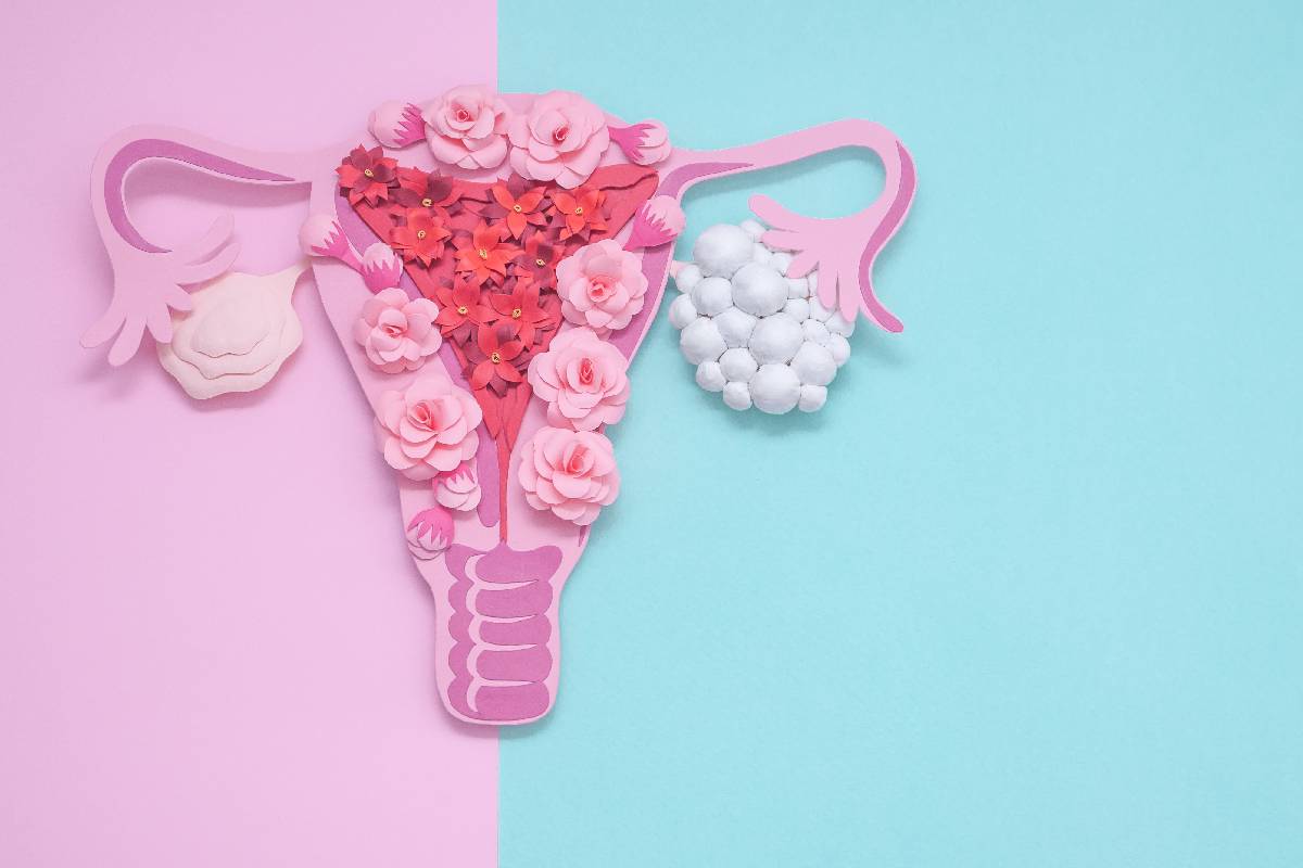 The curious misdiagnosis of PCOS & what is PMOS